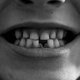 Imagen para el artículo titulado Un anticuerpo podría ser la clave para regenerar los dientes perdidos